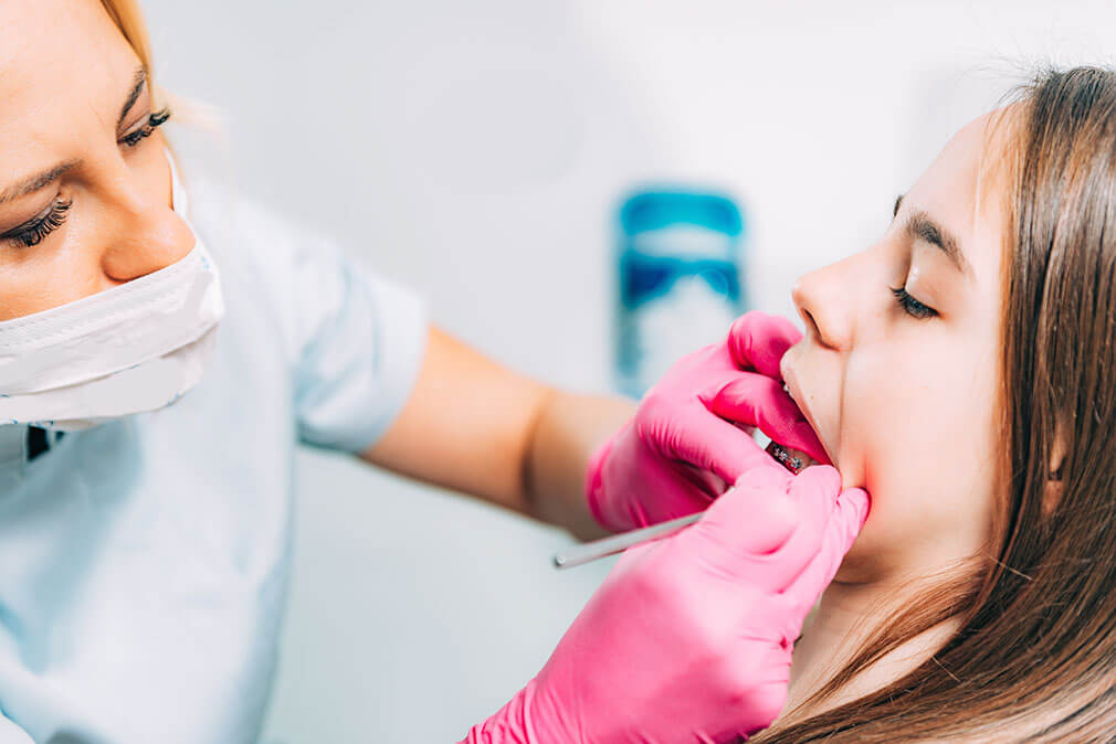 Etter tannregulering: Slik opprettholder du et vakkert smil og sunn tannstilling